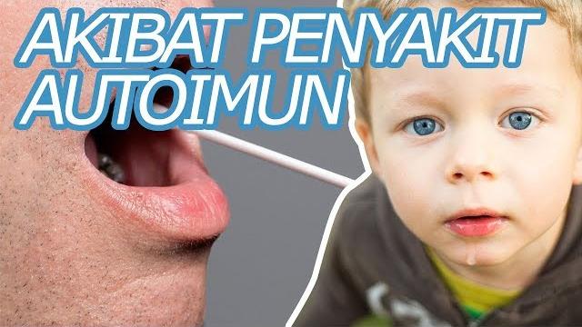 Hipersalivasi, air liur berlebih akibat penyakit! Hipersalivasi, air liur berlebih akibat penyakit!