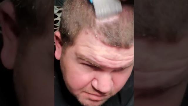 Asmr dandruff scratching #asmrscalpcheck Asmr dandruff scratching #asmrscalpcheck