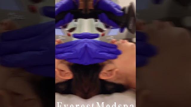 Opus plasma 超离子射频 #opusplasma #超离子 #射频治疗 #医美 #抗衰老 #medspa #everestmedspa #珠峰纯颜医美 #紧肤 #护肤 #祛斑 #美白 Opus plasma 超离子射频 #opusplasma #超离子 #射频治疗 #医美 #抗衰老 #medspa #everestmedspa #珠峰纯颜医美 #紧肤 #护肤 #祛斑 #美白