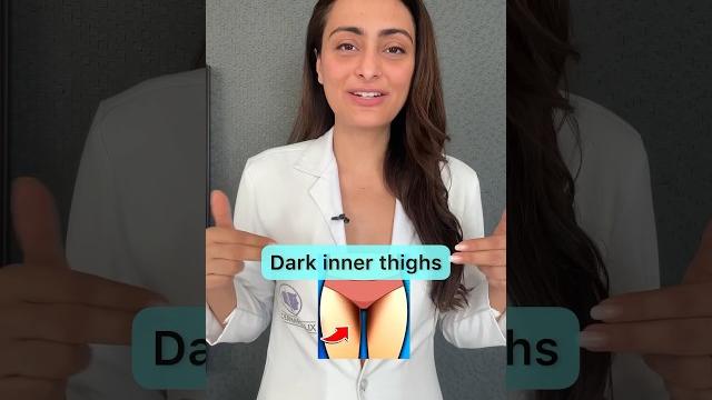 Dark inner thighs | causes and treatment | #dermatologist Dark inner thighs | causes and treatment | #dermatologist