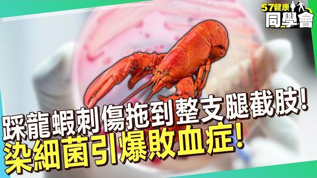 腳踩龍蝦刺傷拖到整支腿截肢! 染細菌引爆敗血症【 @57healthy 】#江坤俊 醫師 腳踩龍蝦刺傷拖到整支腿截肢! 染細菌引爆敗血症【 @57healthy 】#江坤俊 醫師
