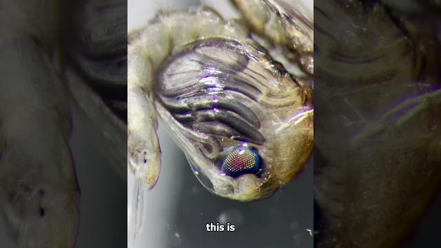 World's deadliest bug bites my hand 1000x magnification World's deadliest bug bites my hand 1000x magnification