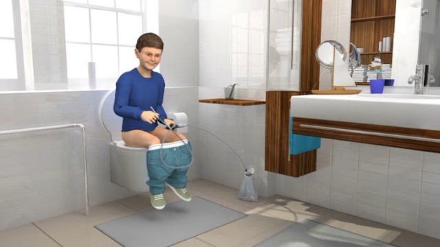 Peristeen for children how to use Peristeen for children how to use