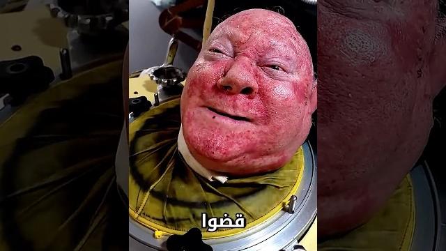 ما سر الرئة الحديدية ما سر الرئة الحديدية