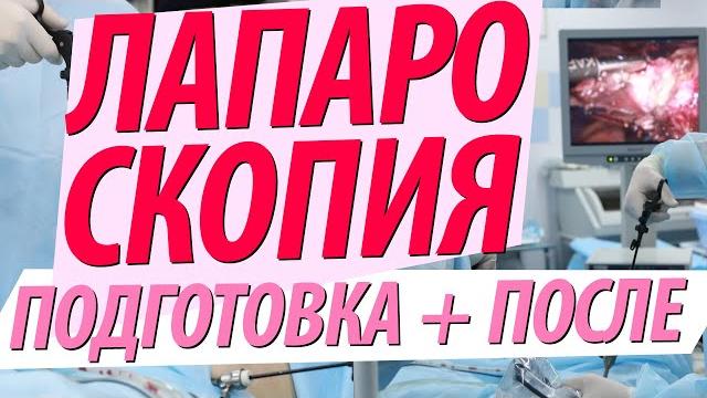 Лапароскопия: подготовка, как проводится, после операции Лапароскопия: подготовка, как проводится, после операции