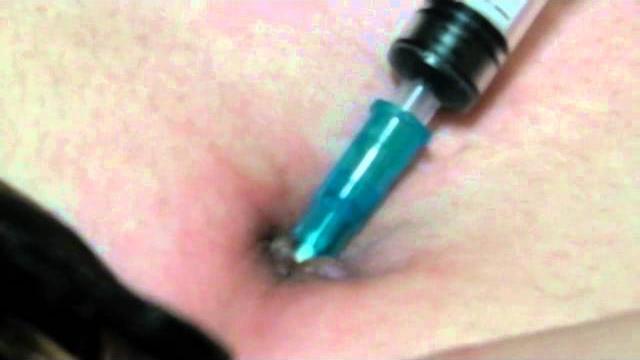 Mai~2 navel needle stab.avi Mai~2 navel needle stab.avi