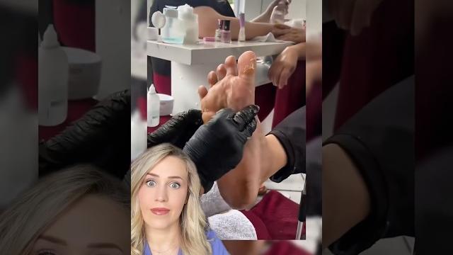 Doctor reacts: extreme foot shaving Doctor reacts: extreme foot shaving
