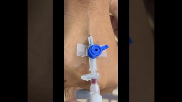 Iv cannula / vigo kaise lagaye | iv cannulation Iv cannula / vigo kaise lagaye | iv cannulation