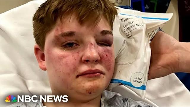 Lesbian teen attacked inside illinois mcdonald's Lesbian teen attacked inside illinois mcdonald's