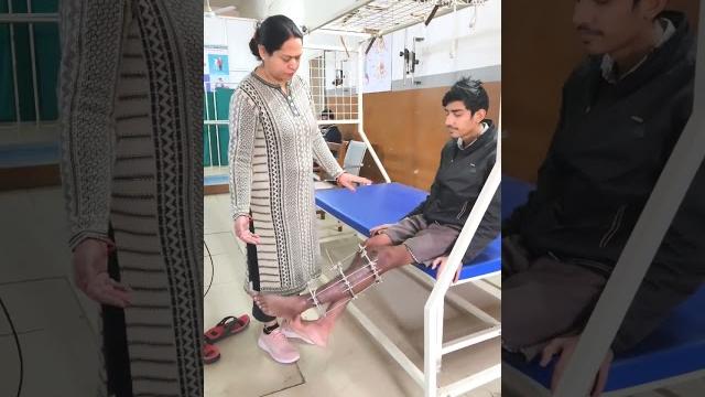 Tibia fracture #gait training #knee range of motion exercise #dr.shilpi gupta # ilizarov fixator Tibia fracture #gait training #knee range of motion exercise #dr.shilpi gupta # ilizarov fixator