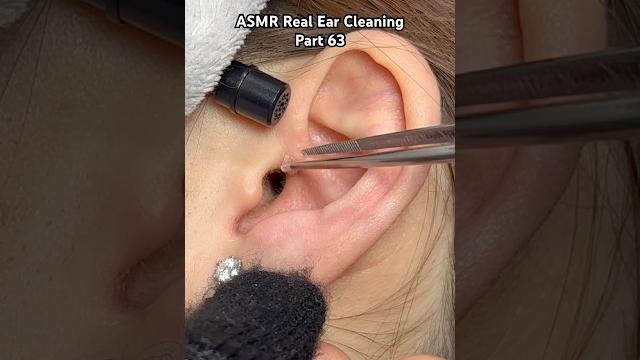 Part 63 | asmr ear cleaning #asmr #earcleaning Part 63 | asmr ear cleaning #asmr #earcleaning