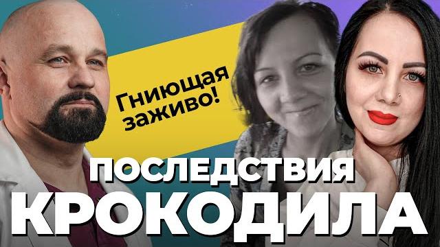 Исповедь наркоманки: гнила заживо, инвалидность, вич, тюрьма! последствия дезоморфина, соли, героина Исповедь наркоманки: гнила заживо, инвалидность, вич, тюрьма! последствия дезоморфина, соли, героина