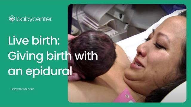 Live birth: epidural Live birth: epidural