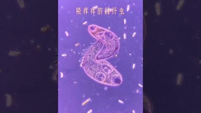 挠痒痒的赭纤虫 微观 挠痒痒的赭纤虫 微观