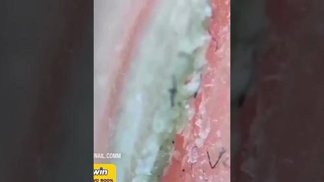 Знали?🪱 #tiktok #ногти #грязь #shorts Знали?🪱 #tiktok #ногти #грязь #shorts
