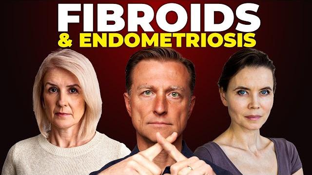 The best fibroid shrinking vitamin (based on science) The best fibroid shrinking vitamin (based on science)
