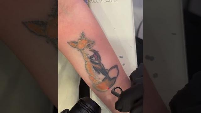 Удаление татуировки при помощи лазера️на шаг впереди к чистой кожеsokolov laser! москва. Удаление татуировки при помощи лазера️на шаг впереди к чистой кожеsokolov laser! москва.