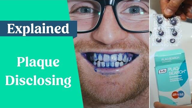 How to use plaque disclosing tablets How to use plaque disclosing tablets