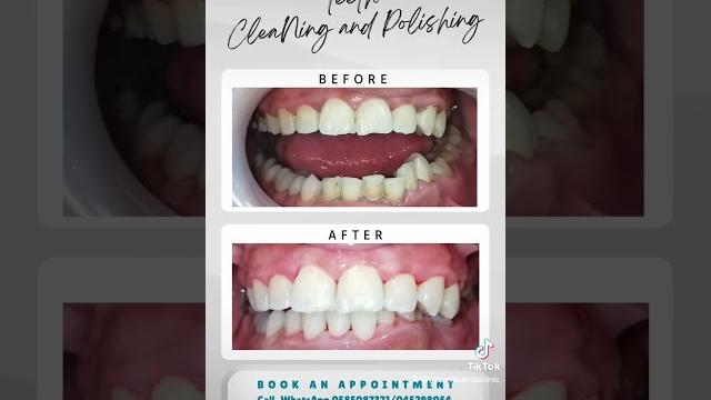 Simple procedure that can do magic Simple procedure that can do magic