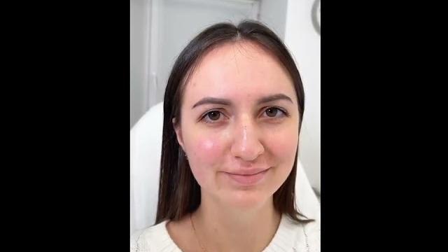 Лицо под ключ Лицо под ключ