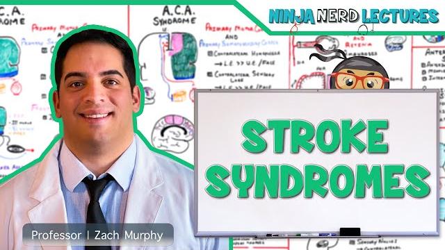 Stroke syndromes: mca, aca, ica, pca, vertebrobasilar artery strokes | pathophysiology Stroke syndromes: mca, aca, ica, pca, vertebrobasilar artery strokes | pathophysiology
