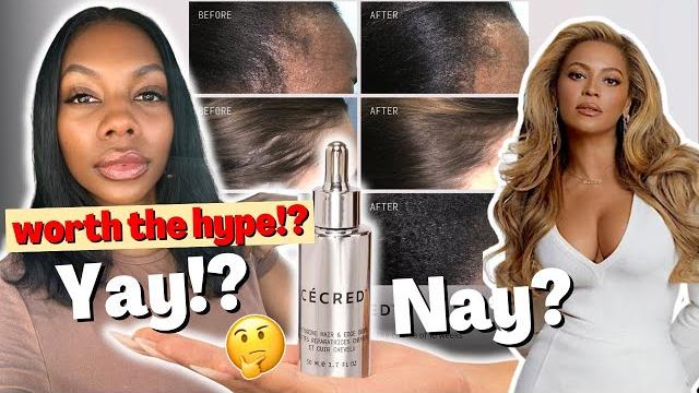 Wtf is in beyoncé’s cecred restoring hair & edge drops?! is this worth your money and the hype ??? Wtf is in beyoncé’s cecred restoring hair & edge drops?! is this worth your money and the hype ???