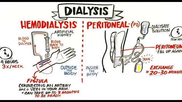 Failing kidneys and different treatment options Failing kidneys and different treatment options