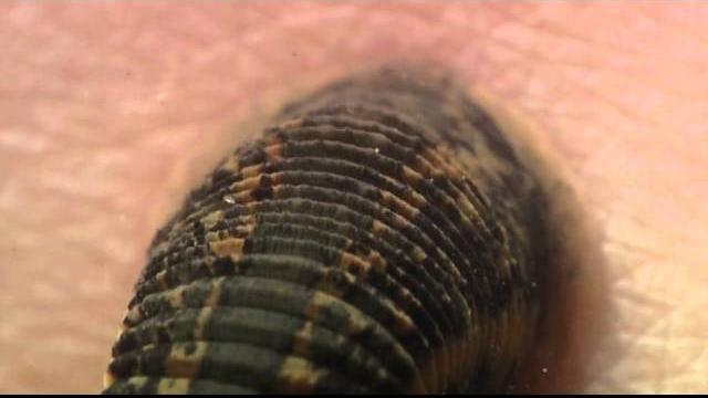 Shape of life: annelids - leeches Shape of life: annelids - leeches