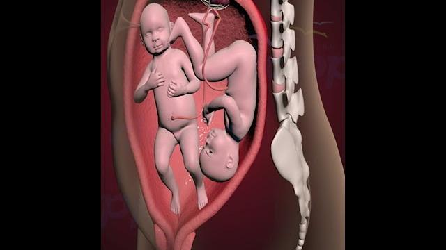 Amazing twins fighting inside the womb for supremacy (3d animation) Amazing twins fighting inside the womb for supremacy (3d animation)