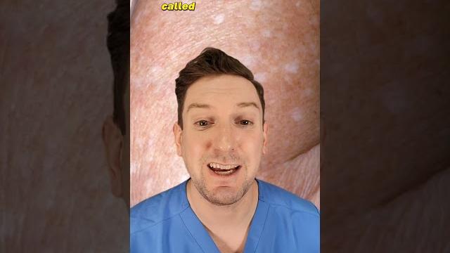 What are those white spots on your arms? dermatologist explains idiopathic guttate hypomelanosis What are those white spots on your arms? dermatologist explains idiopathic guttate hypomelanosis