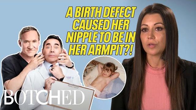 Samantha's nipple is in her armpit because of a birth defect?! (before & after) | botched | e! Samantha's nipple is in her armpit because of a birth defect?! (before & after) | botched | e!