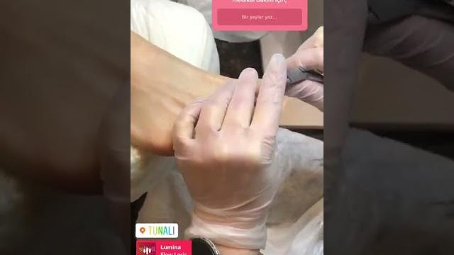 Medi̇kal ayak bakimi Medi̇kal ayak bakimi