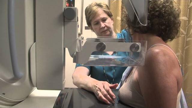Mammogram what you need to know Mammogram what you need to know