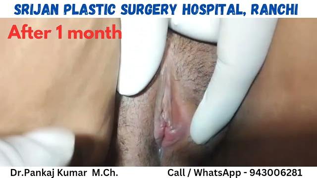 Designer vegina - genital cosmetic surgery| labiaplasty & hymenoplasty surgery in ranchi Designer vegina - genital cosmetic surgery| labiaplasty & hymenoplasty surgery in ranchi