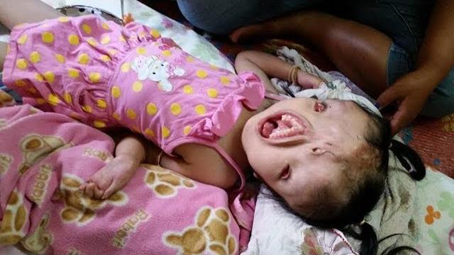 Unusual kids born with bizarre medical conditions Unusual kids born with bizarre medical conditions